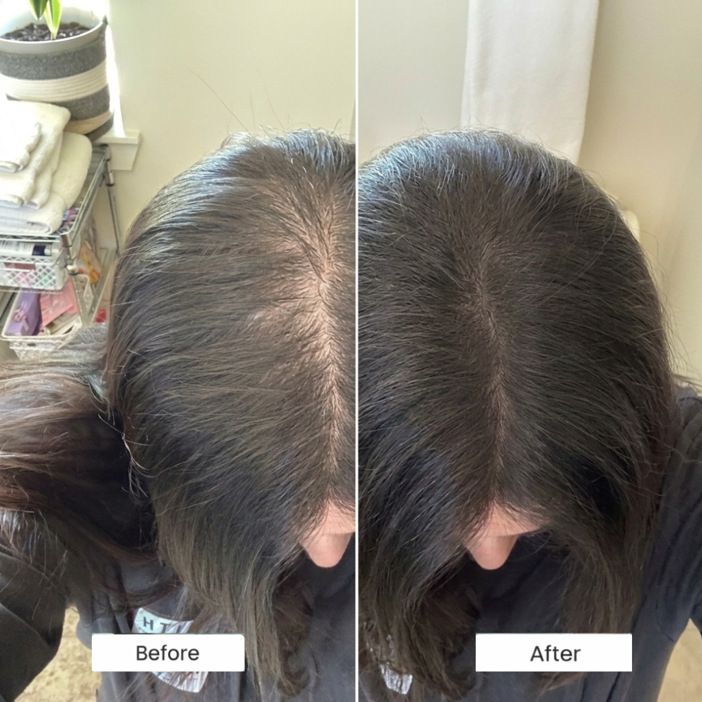 The 3-Step Hormonal Hair Ritual™